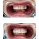 Slider image (9) Prestij Dental Clinic